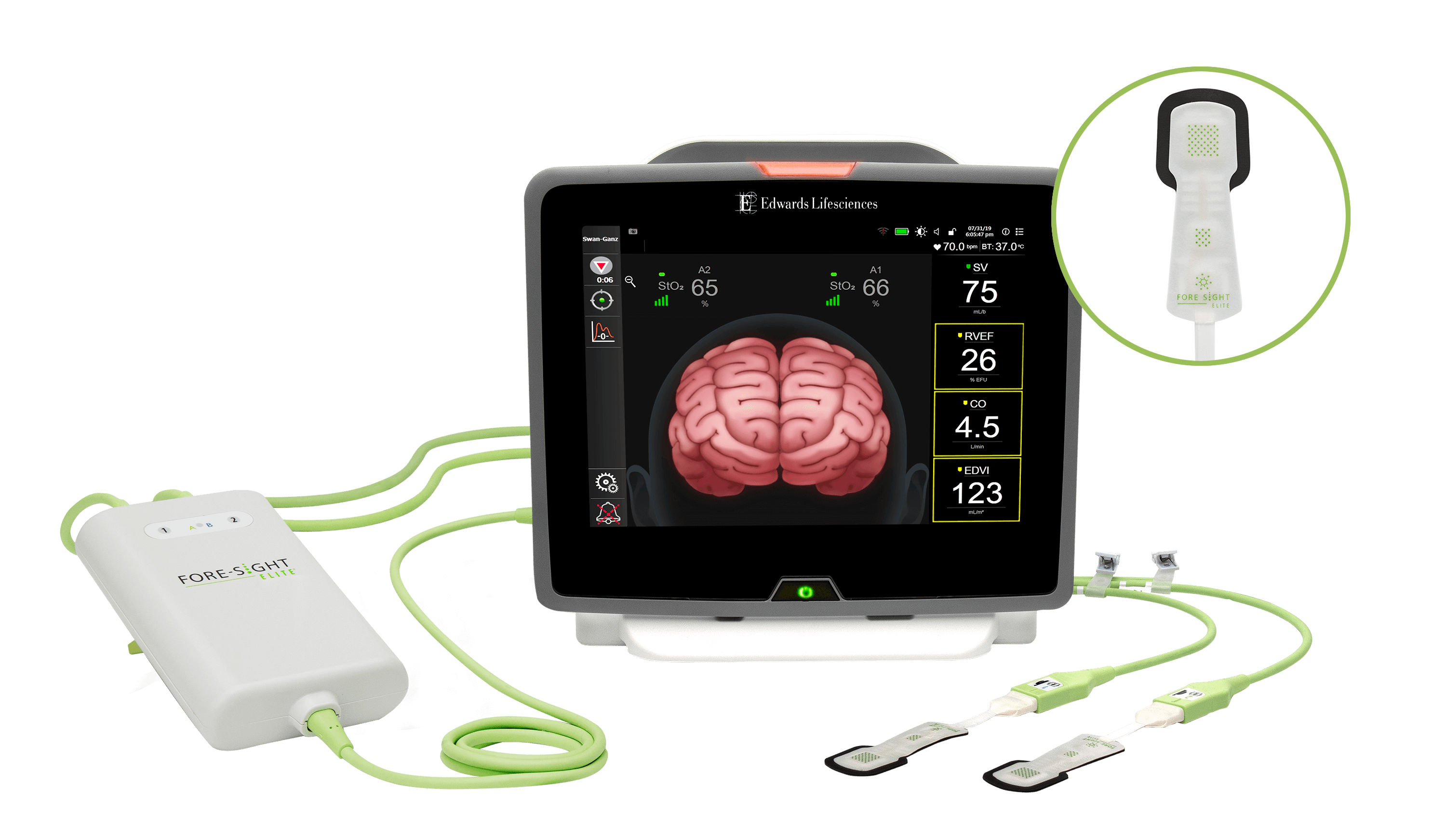 ForeSight Elite System